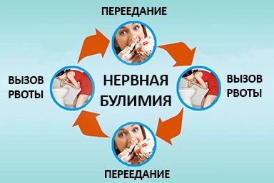 Лечение булимии в Юце